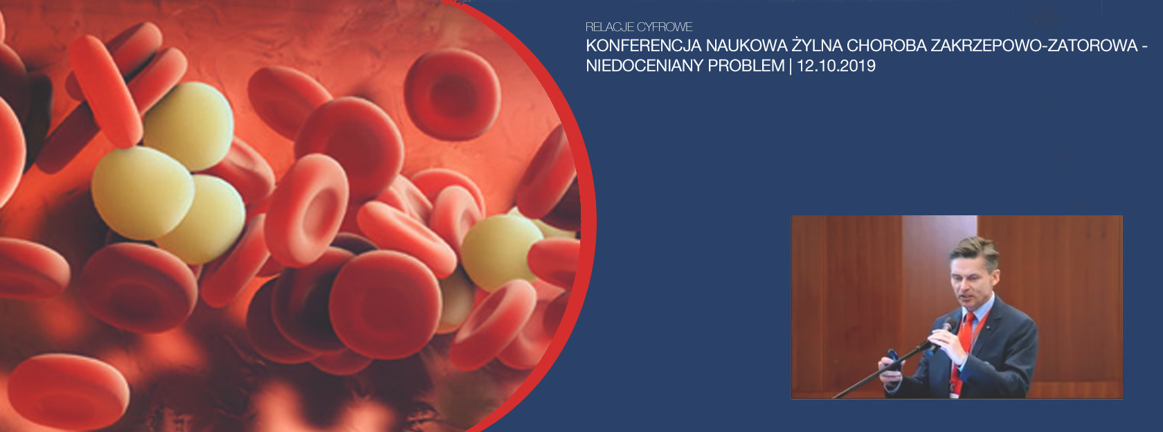 NOCNA NAPADOWA HEMOGLOBINURIA – NAJCIĘŻSZA NABYTA TROMBOFILIA