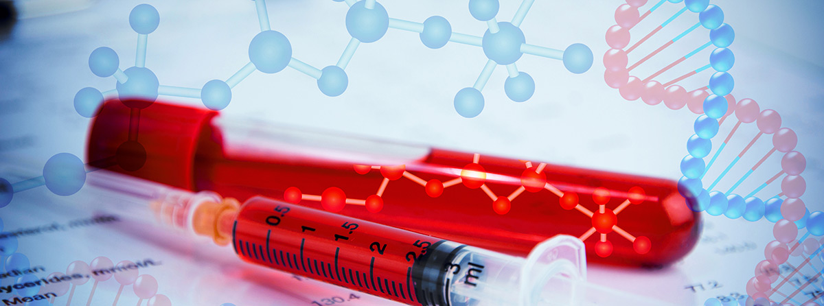 Skuteczność oraz czynniki predykcyjne indukcji tolerancji immunologicznej u chorych na hemofilię powikłaną inhibitorem - wyniki badania japońskiego