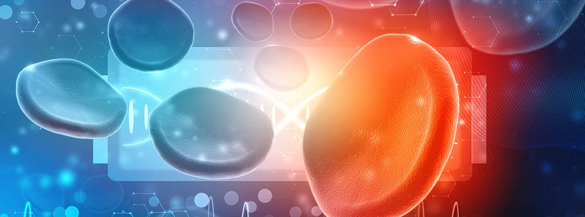 Żylna choroba zakrzepowo-zatorowa u chorych z małopłytkowością immunologiczną - wyniki retrospektywnej, wieloośrodkowej analizy