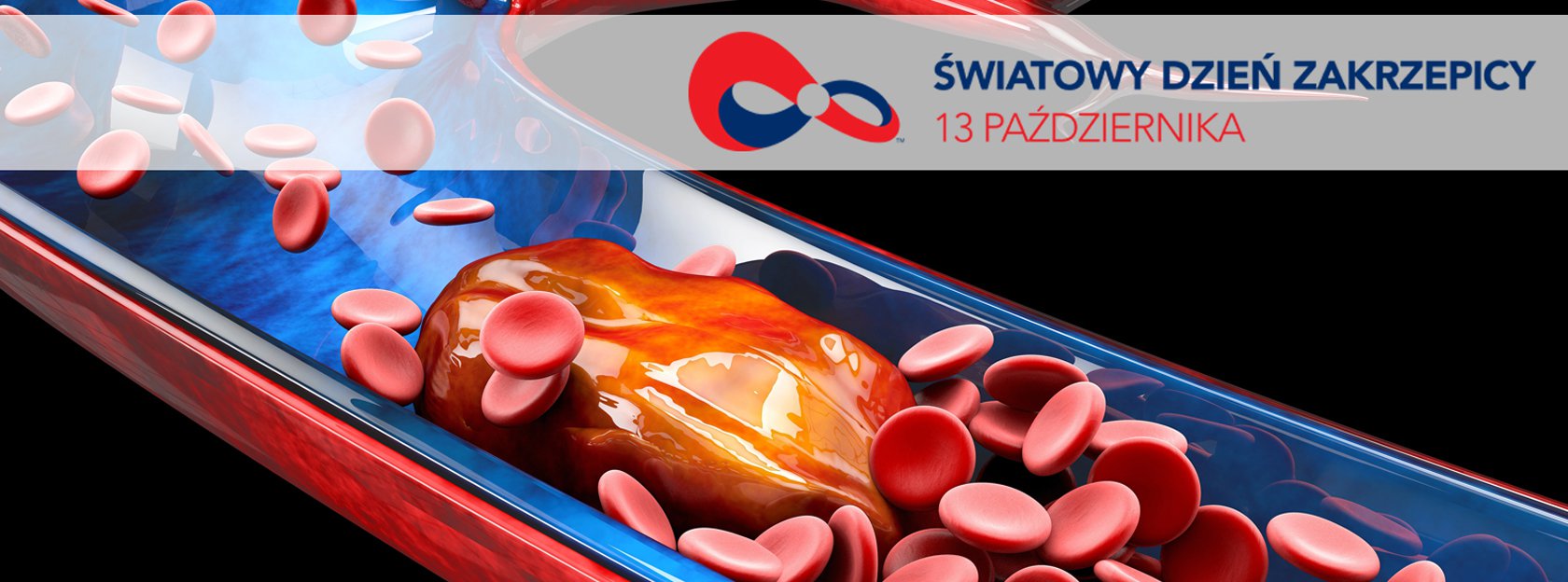 13 października | Światowy Dzień Zakrzepicy