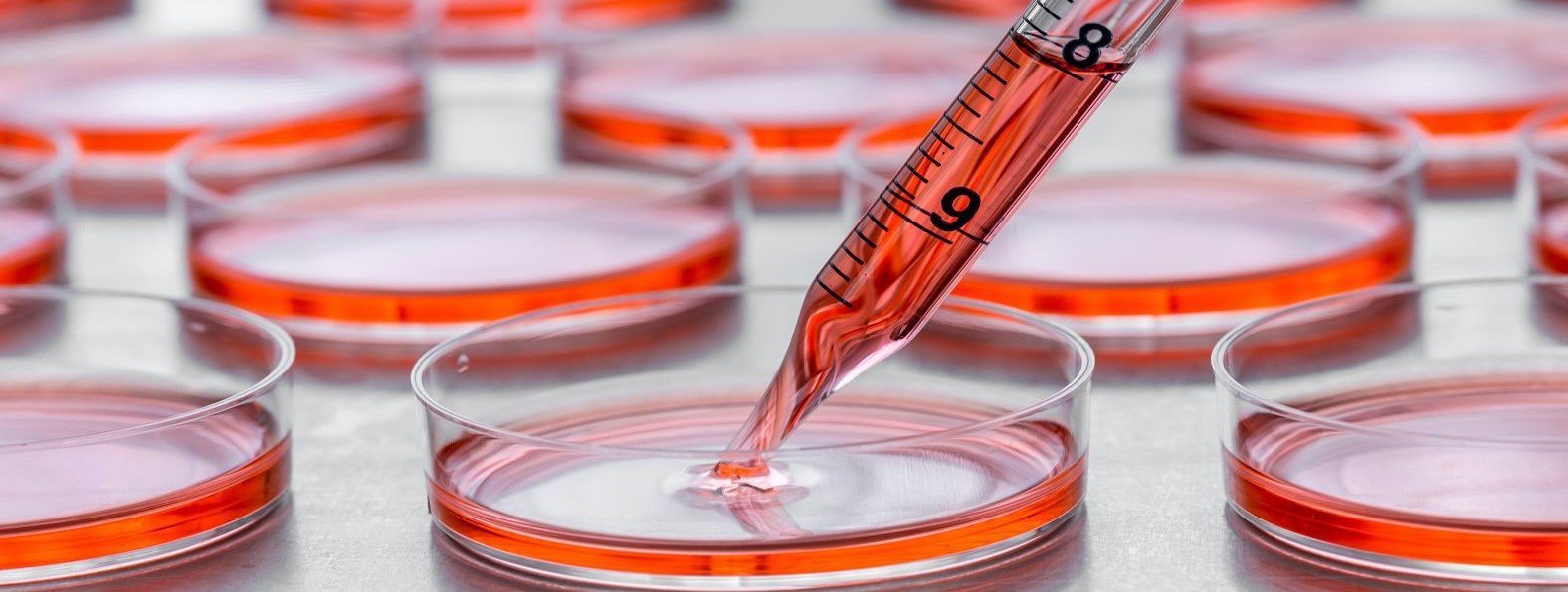 Historia i rola testu wiązania kolagenu z czynnikiem von Willebranda (VWF:CB) w diagnostyce i leczeniu choroby von Willebranda (VWD)