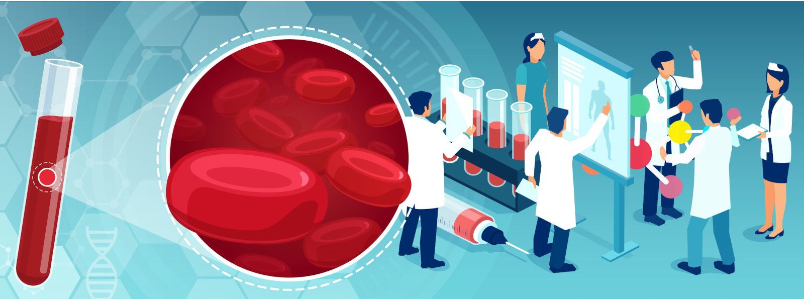 Oznaczanie antykoagulantu tocznia oraz interpretacja wyników - aktualizacja zaleceń International Society on Thrombosis and Haemostasis (2020 rok)
