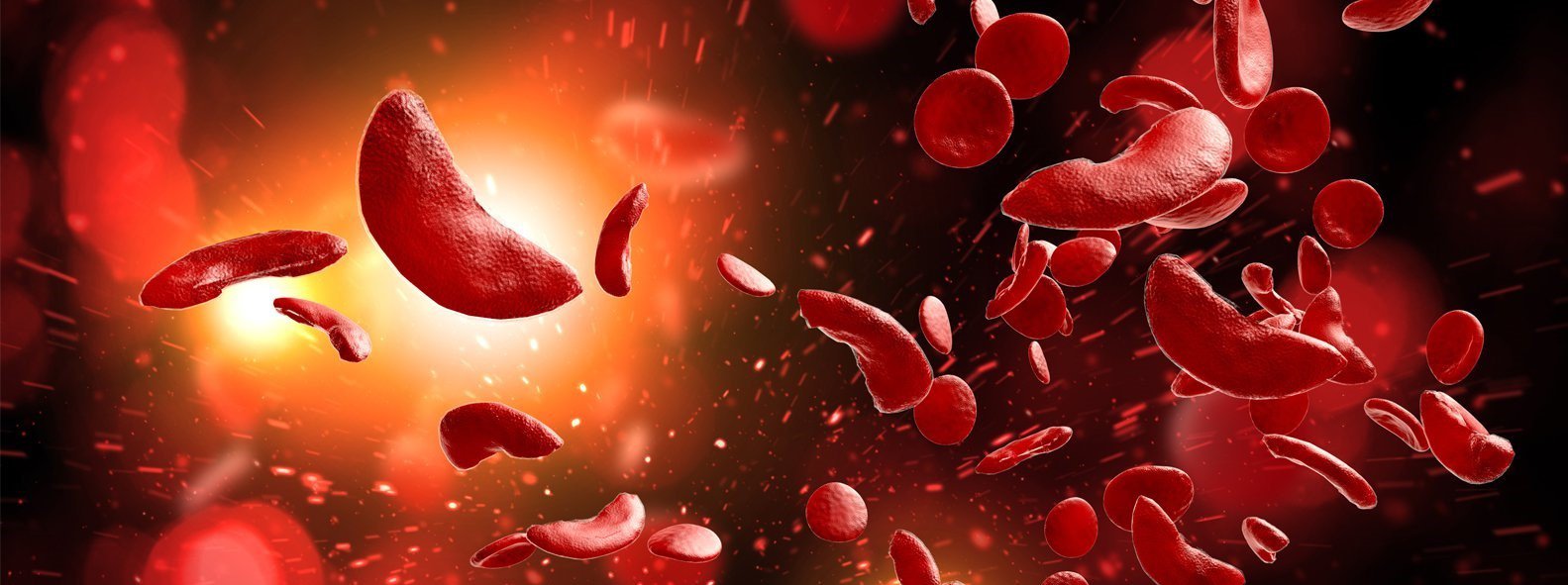 Niska immunogenność emicizumabu u pacjentów z hemofilią A