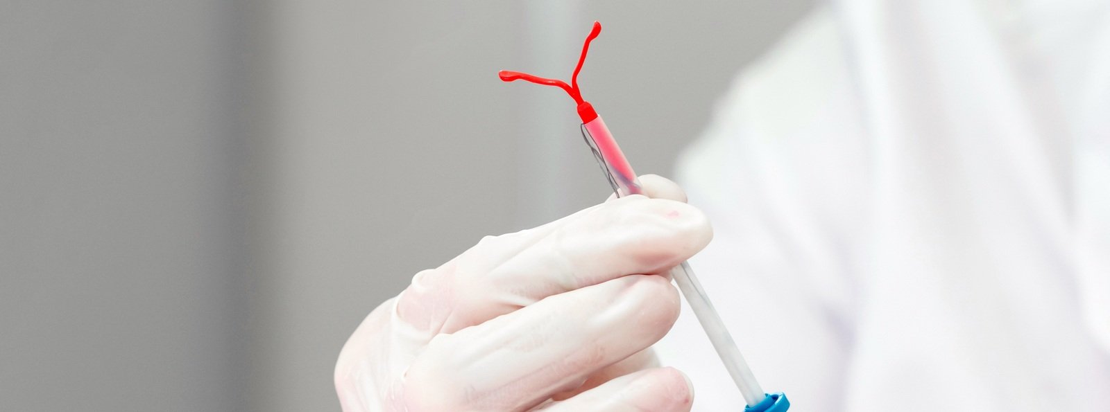 Ryzyko nawrotu żylnej choroby zakrzepowo-zatorowej (ŻChZZ) u młodych kobiet stosujących hormonalne środki antykoncepcyjne