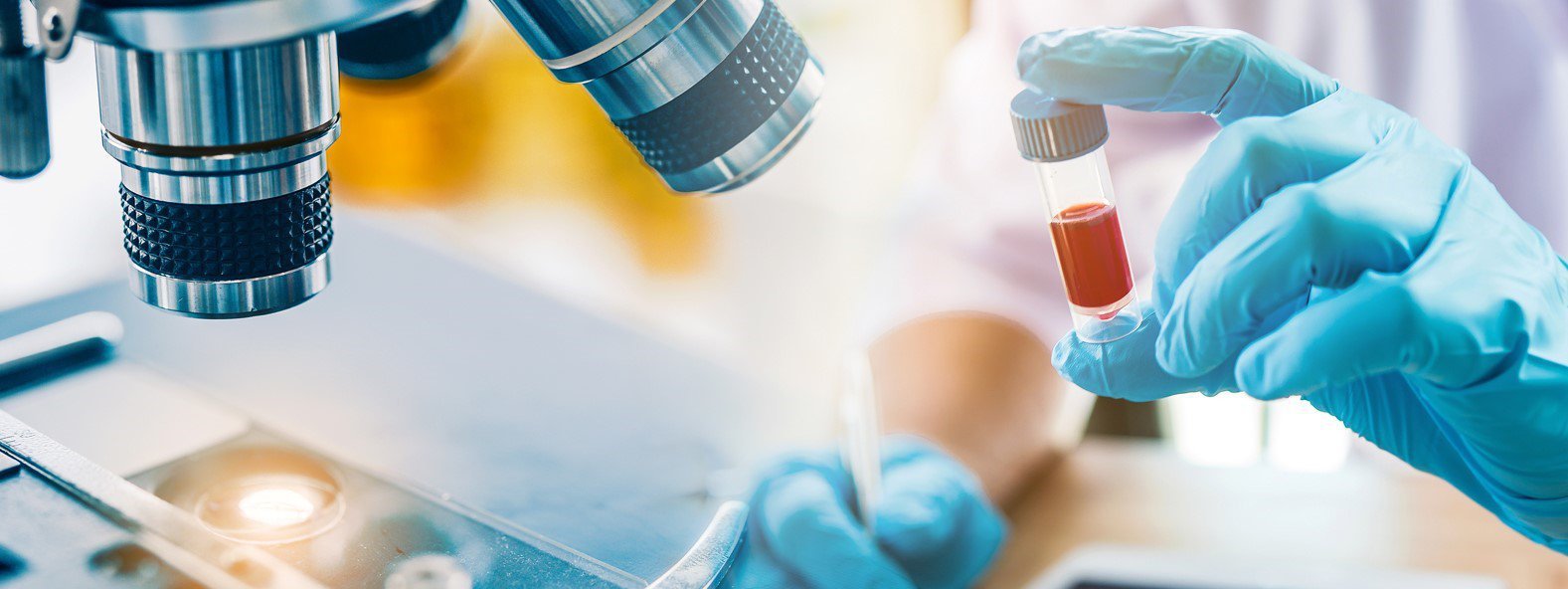 Zasady laboratoryjnego monitorowania leczenia nabytej hemofilii A produktem OBIZUR®