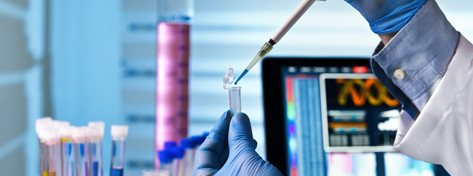 Test Bethesda w diagnostyce inhibitora czynnika VIII