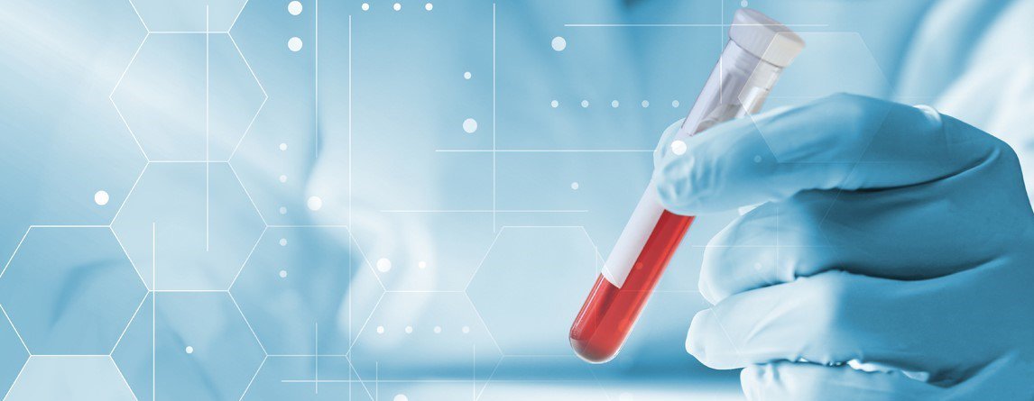 Diagnostyka laboratoryjna niedoboru białka S  w świetle najnowszych zaleceń