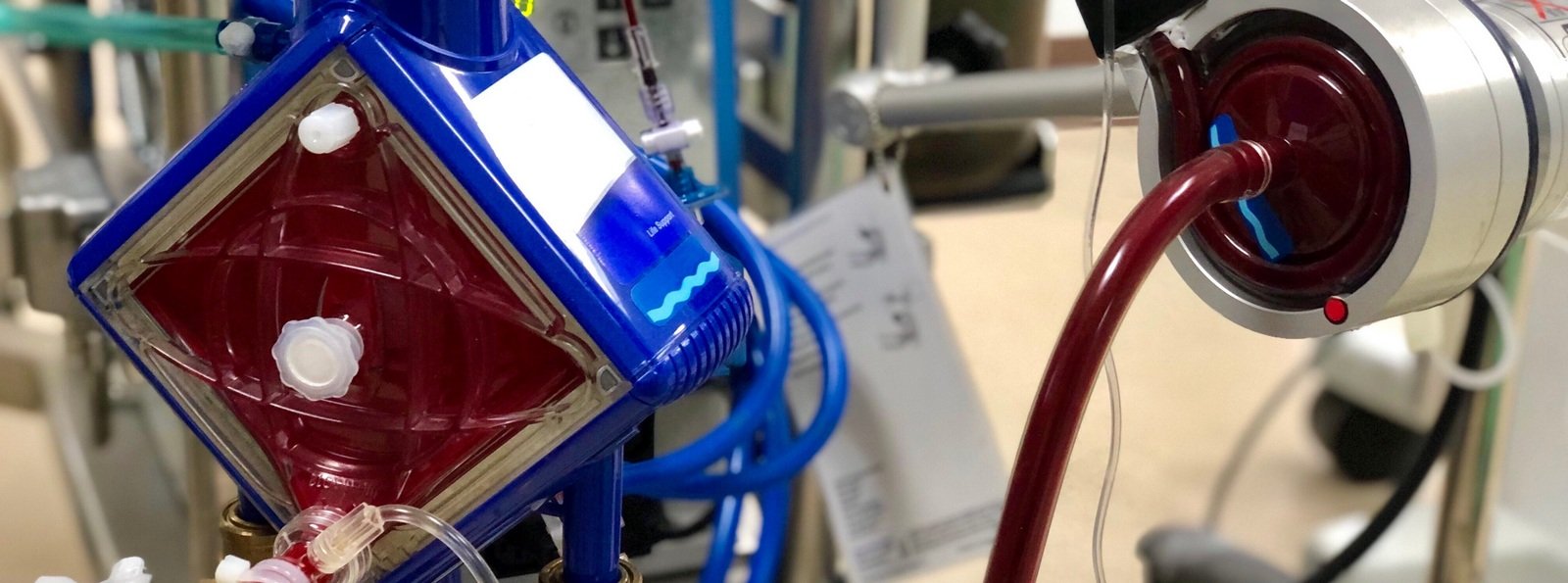Interpretacja badań laboratoryjnych krzepnięcia u pacjentów leczonych ECMO