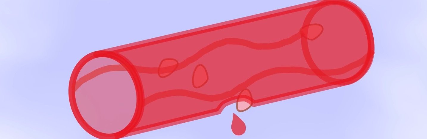 Czym jest hemofilia?