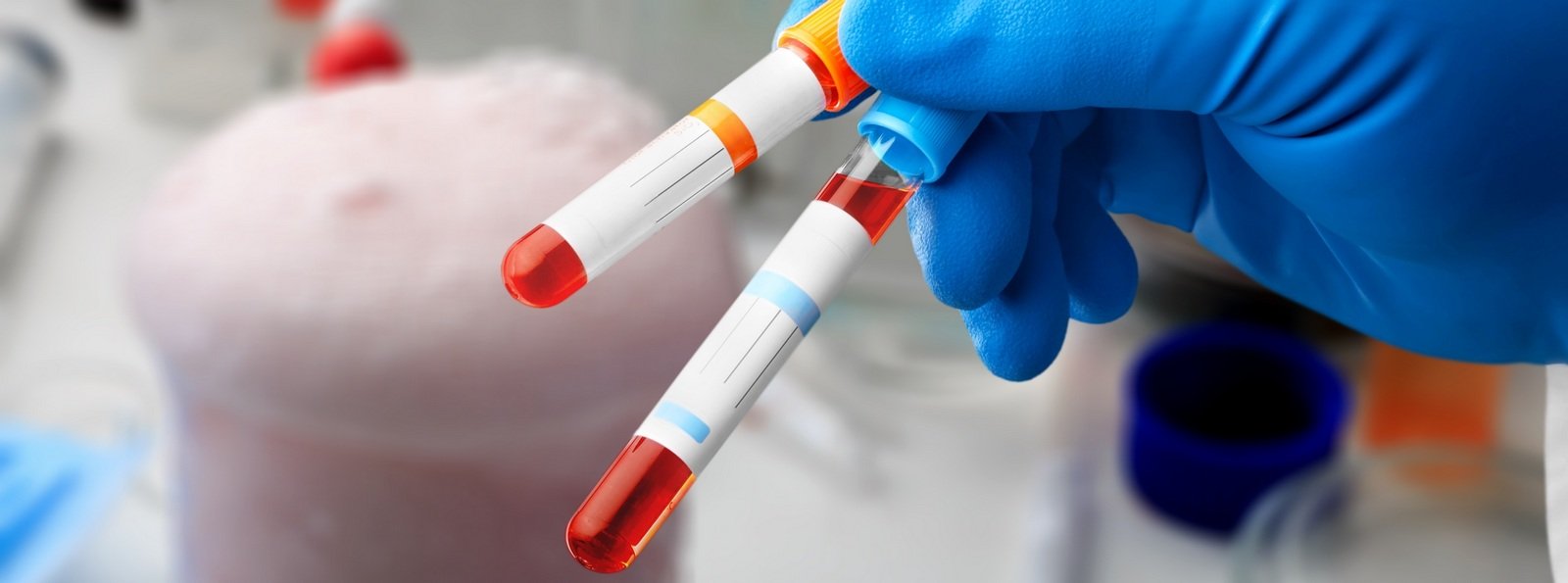 Zgodność między testem koagulacyjnym jednoetapowym a testem chromogennym w próbkach od pacjentów otrzymujących rekombinowany wieprzowy FVIII (Obizur, Susoctocog-alfa)