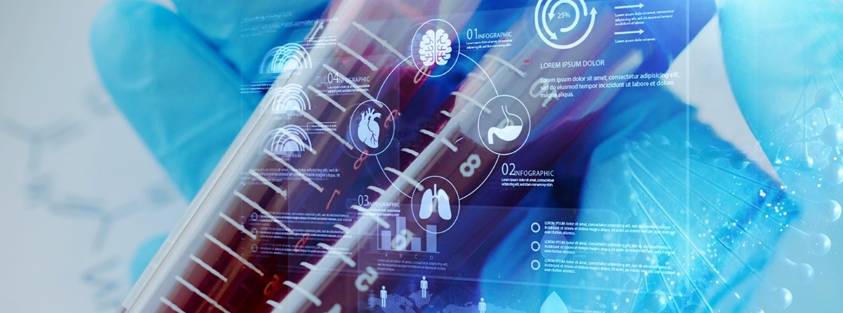 Laboratoryjne monitorowanie leczenia substytucyjnego hemofilii A koncentratami o przedłużonym działaniu  - aktualny stan wiedzy