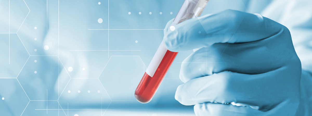 Małopłytkowość poheparynowa (HIT) – od podejrzenia klinicznego do szybkiej diagnostyki