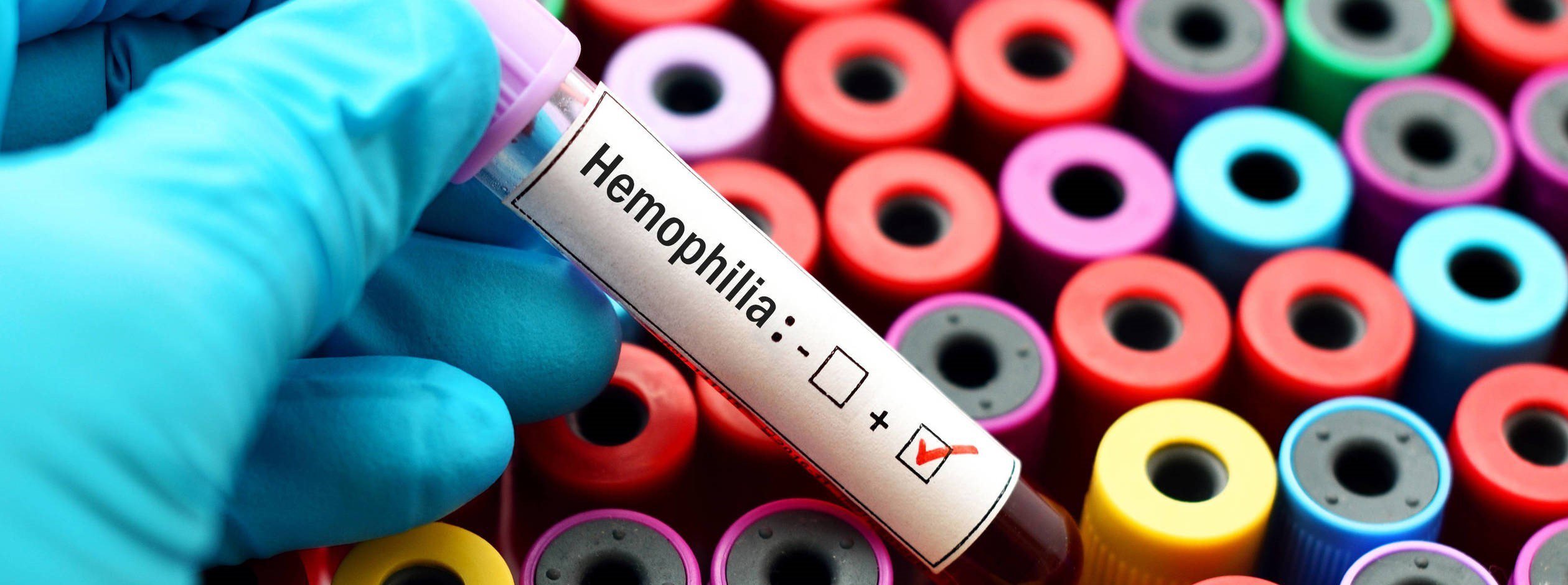 Z powodu tej choroby cierpią nie tylko mężczyźni