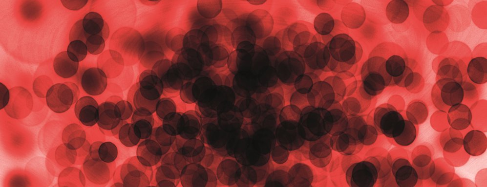 „Niezbędnik laboratoryjny” terapii emicizumabem (HEMLIBRA®)