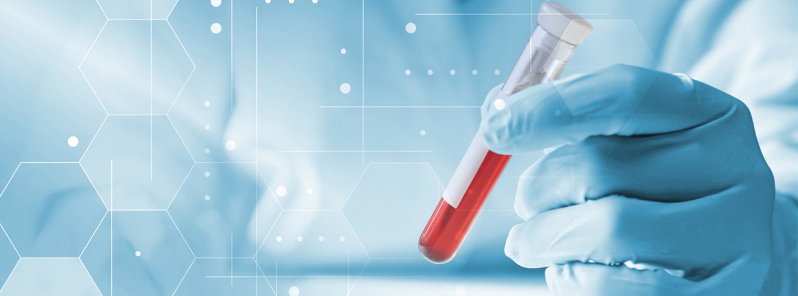Zaplecze laboratoryjne ośrodków realizujących „Narodowy Program Leczenia Chorych na Hemofilię i Pokrewne Skazy Krwotoczne na lata 2019-2023” – stan na wrzesień 2020r.