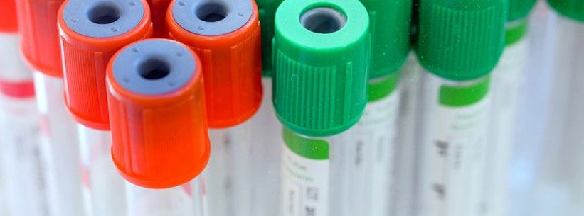 Małopłytkowość indukowana heparyną (HIT) u chorych w ciężkim stanie klinicznym