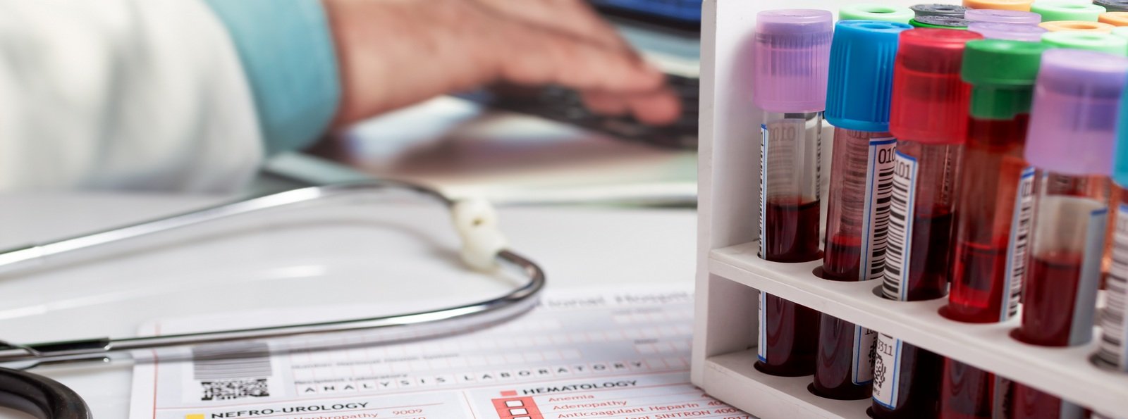 Niskodawkowa indukcja tolerancji immunologicznej w ciężkiej hemofilii A u dzieci w Chinach: wczesne rozpoczęcie terapii dało lepsze wyniki eradykacji inhibitorów