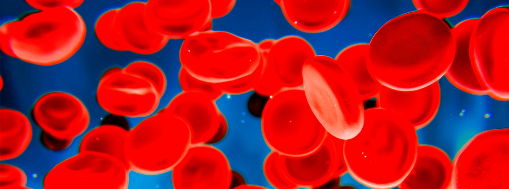 Postępowanie w stanach nagłych u chorych na hemofilię A powikłaną inhibitorem leczonych emicizumabem