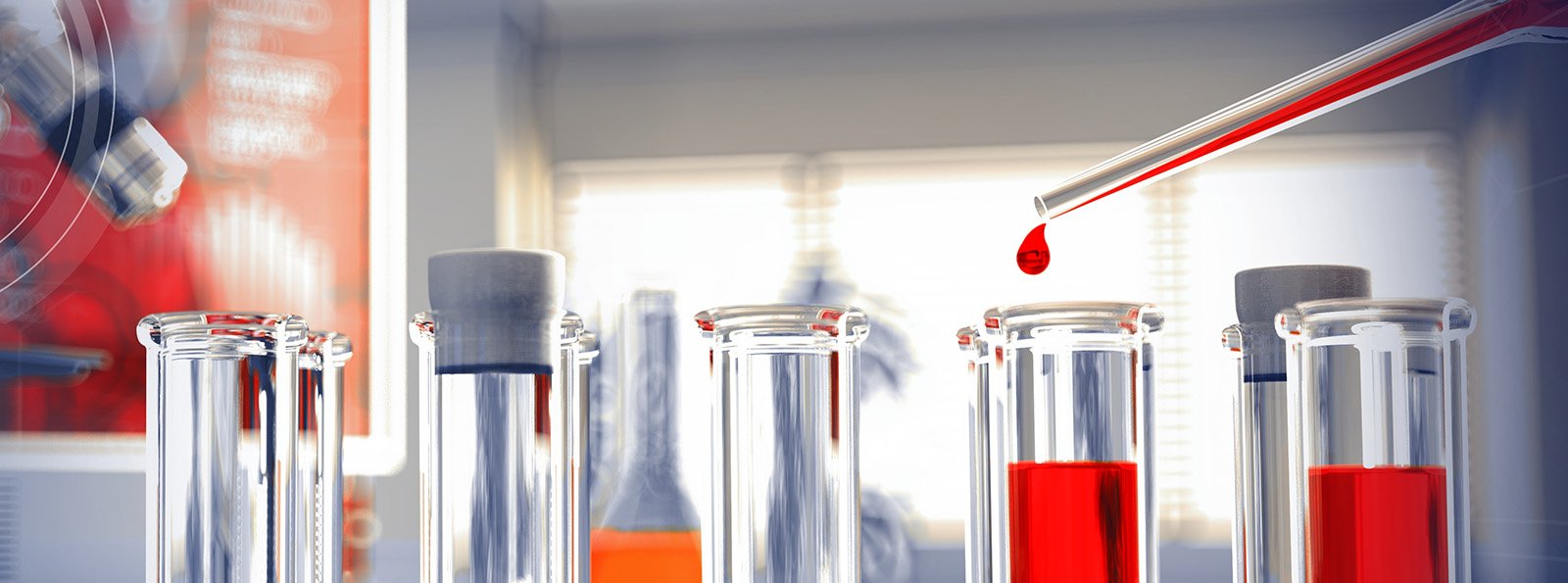 Potencjalne „pułapki” w testach laboratoryjnych oznaczania dimeru D (D-D)