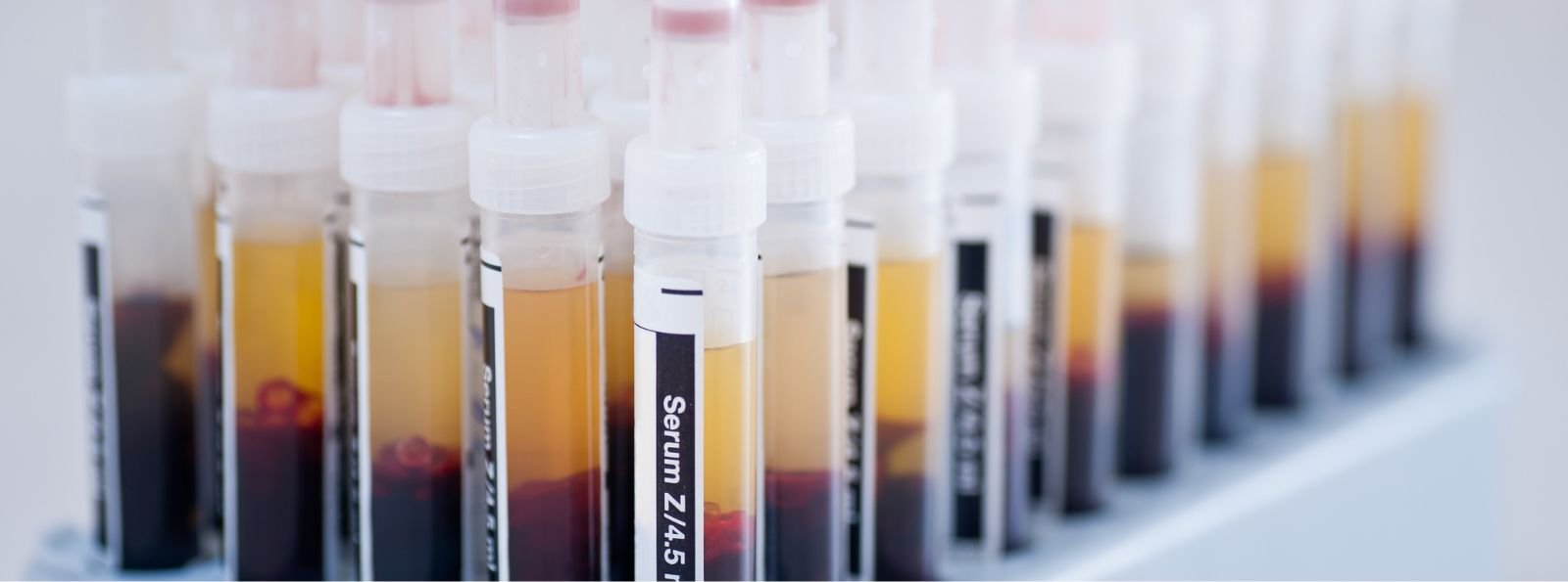 Jakość życia i oszczędność kosztów – marstacimab w profilaktyce hemofilii