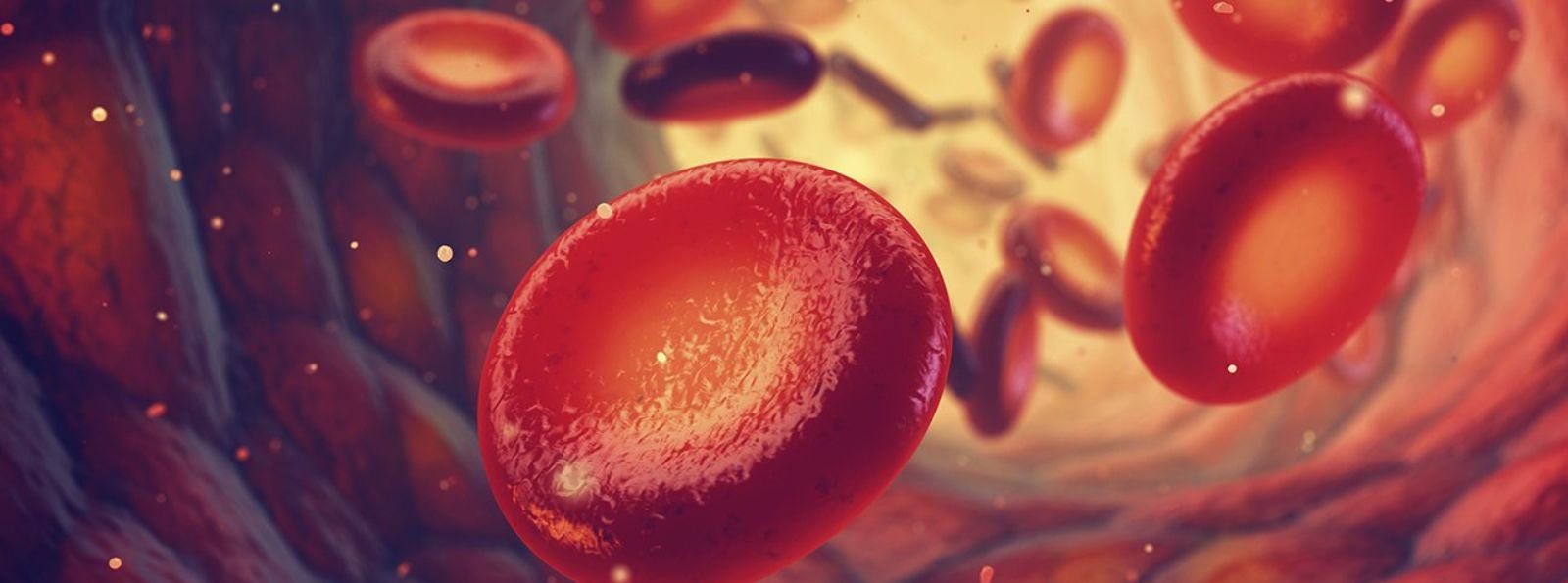 Zastosowanie koncentratu aktywowanych czynników zespołu protrombiny u pacjentów otrzymujących emicizumab – nowe dowody, rozważania kliniczne