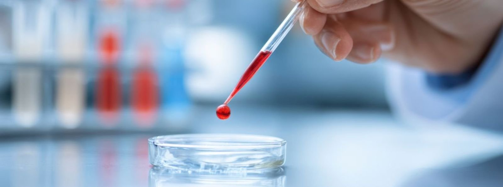 Klasyfikacja zaburzeń związanych z aktywacją płytek krwi i działaniem czynnika płytkowego 4 (PF4)