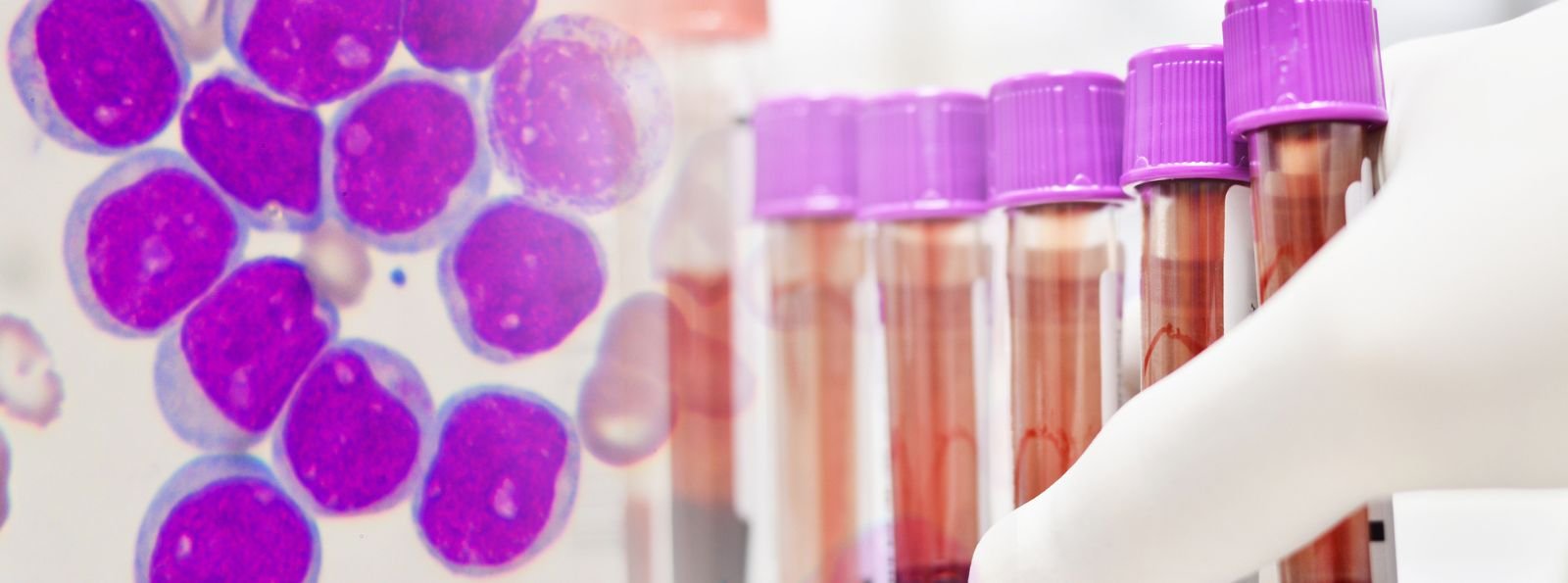 Emicizumab wpisany na Listę Leków Podstawowych Światowej Organizacji Zdrowia dla profilaktyki w hemofilii A u dorosłych i dzieci