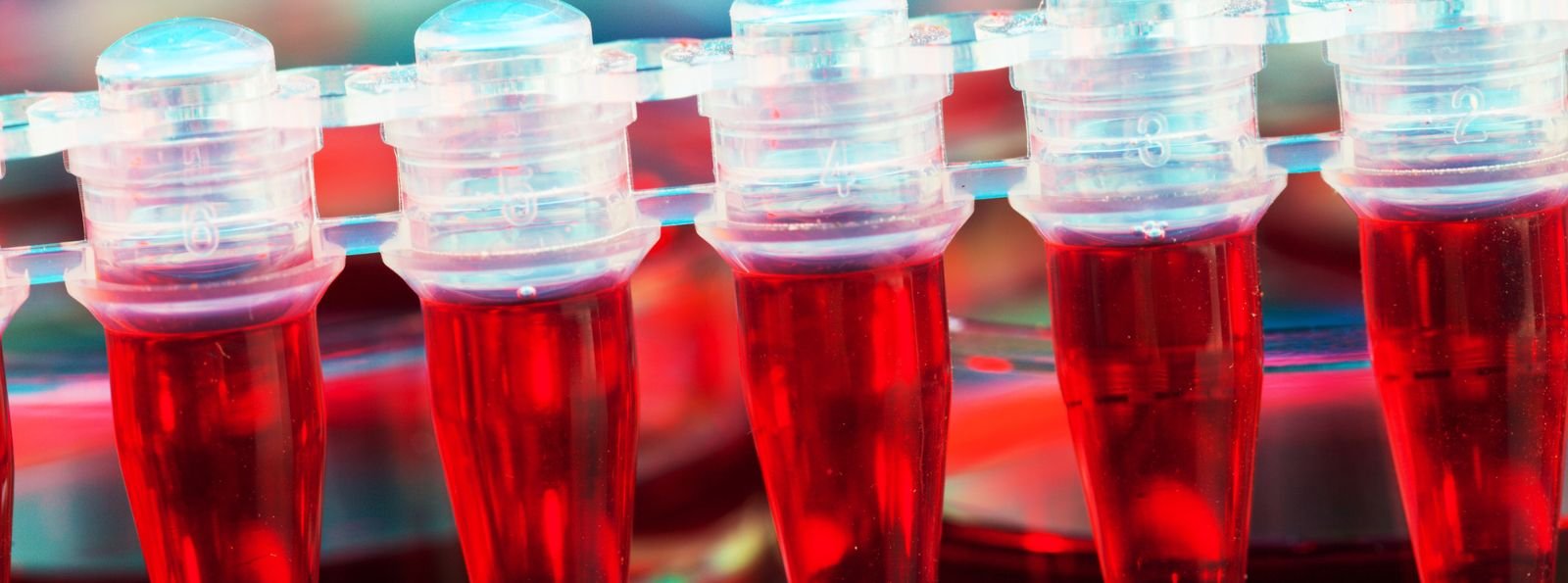 Czym jest hemofilia?