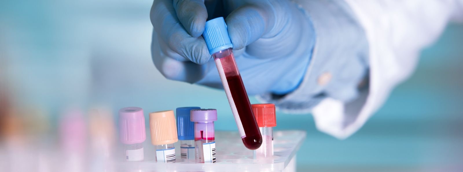 Pomiar poziomu bezpośredniego doustnego leku przeciwkrzepliwego (DOAC): zastosowania, ograniczenia i przyszłe kierunki badań