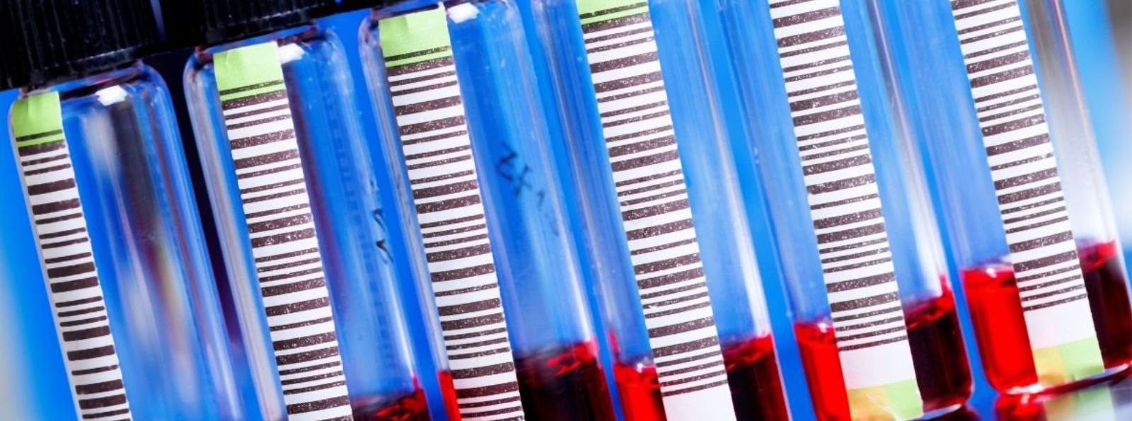 100 lat diagnostyki vWD: od testu kofaktora rystocetyny do badań genetycznych