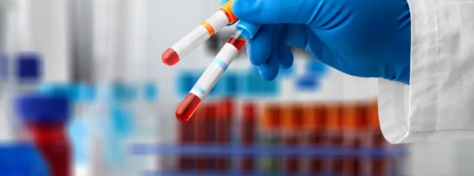 100 lat diagnostyki choroby von Willebranda – od prostych testów do badań genetycznych