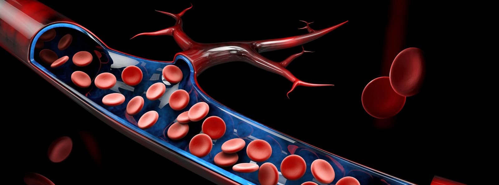 Ryzyko powikłań zakrzepowo-zatorowych u dorosłych pacjentów z pierwotną małopłytkowością immunologiczną leczonych agonistami receptora trombopoetyny