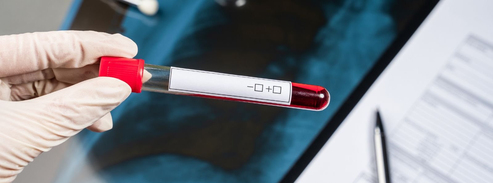 Choroba von Willebranda u kobiet: kiedy miesiączka i poród wymagają szczególnej ostrożności