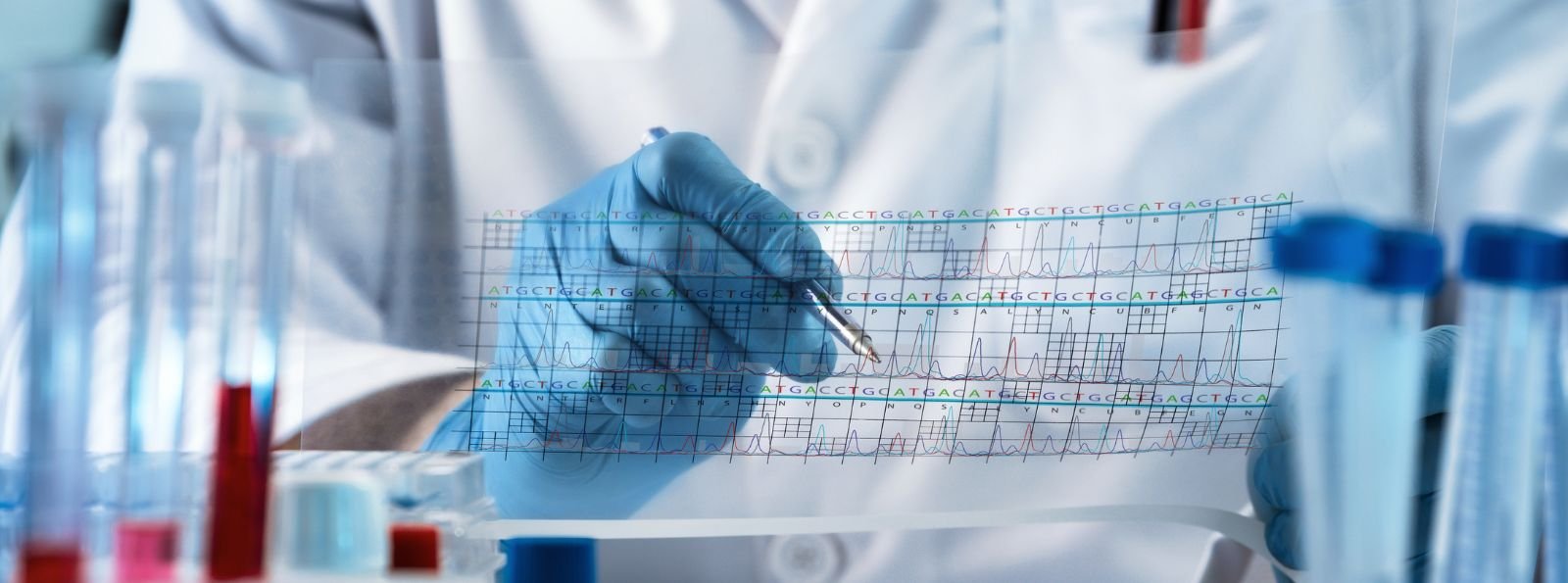 Przejściowe reakcje kompleksów immunologicznych (TICR) przy zmianie inhibitora C5 u pacjentów z PNH – charakterystyka, objawy i postępowanie kliniczne