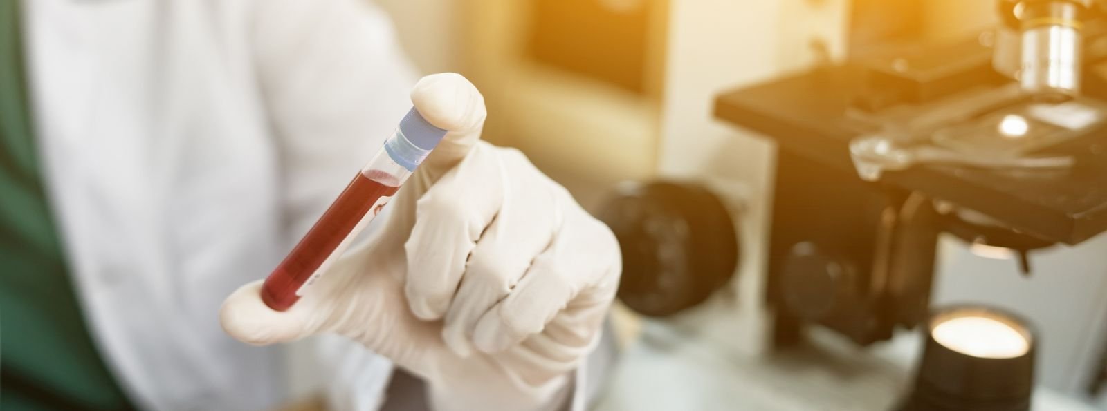 Rywaroksaban z następową aspiryną w porównaniu z samą aspiryną jako profilaktyka przeciwzakrzepowa po całkowitej wymianie stawu biodrowego lub kolanowego. Badanie EPCAT III
