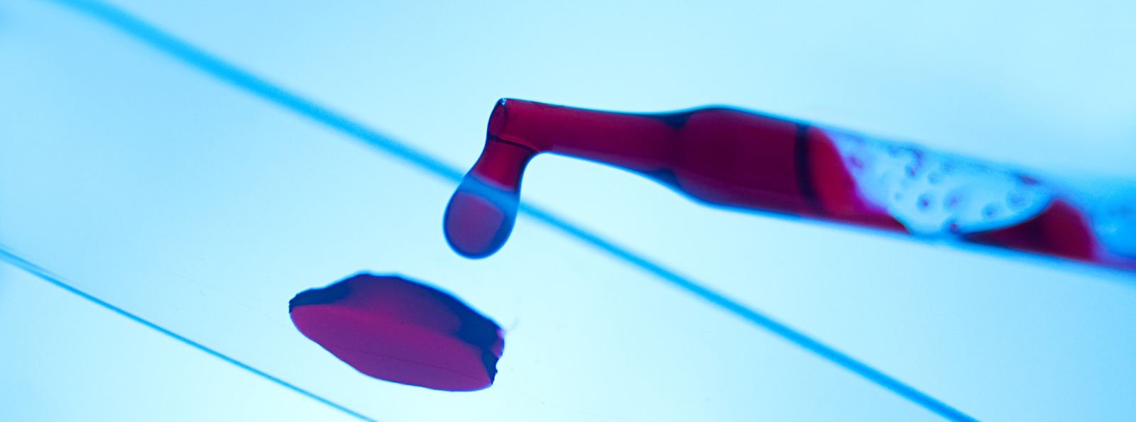 Subanaliza populacji pediatrycznej badania TSUBASA, ocena aktywności fizycznej, krwawień, jakości życia i bezpieczeństwa u osób z hemofilią A otrzymujących Emicizumab