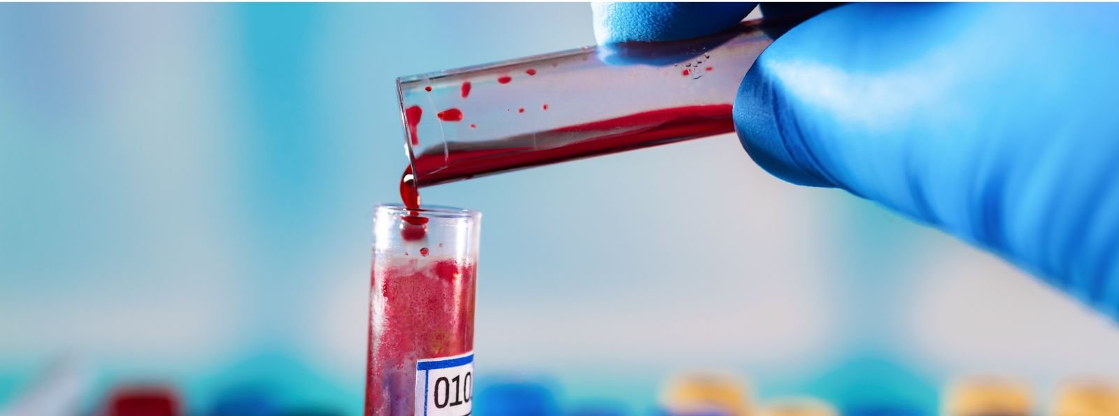 Zalecenia Międzynarodowej Rady Normalizacji Hematologii (ICSH) dotyczące wykonywania i interpretacji testów mieszania dla czasu częściowej tromboplastyny po aktywacji i czasu protrombinowego