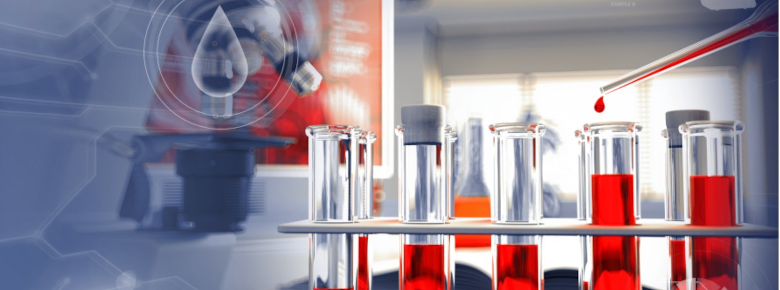 Rekomendacje PTOHD: Nowe podejście do immunotolerancji u dzieci z hemofilią A i inhibitorem czynnika VIII