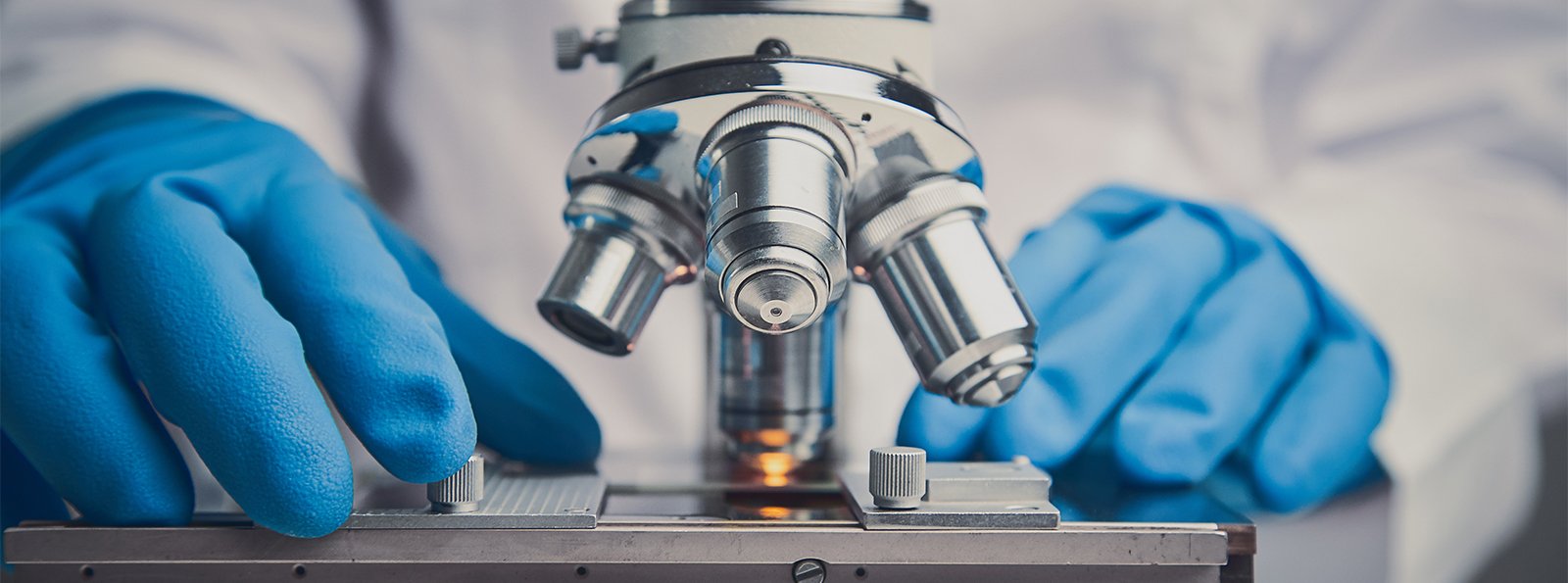 Badania laboratoryjne w diagnostyce zaburzeń fibrynogenu