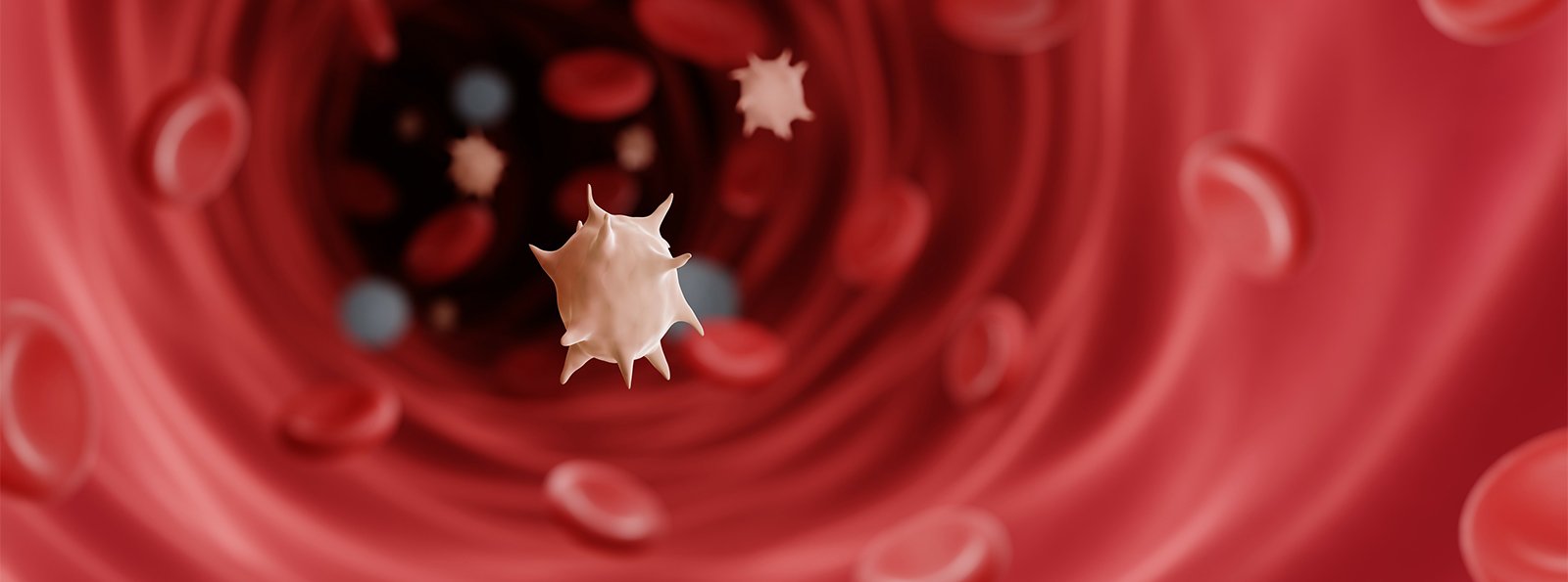 Oporna postać pierwotnej małopłytkowości immunologicznej u osób dorosłych