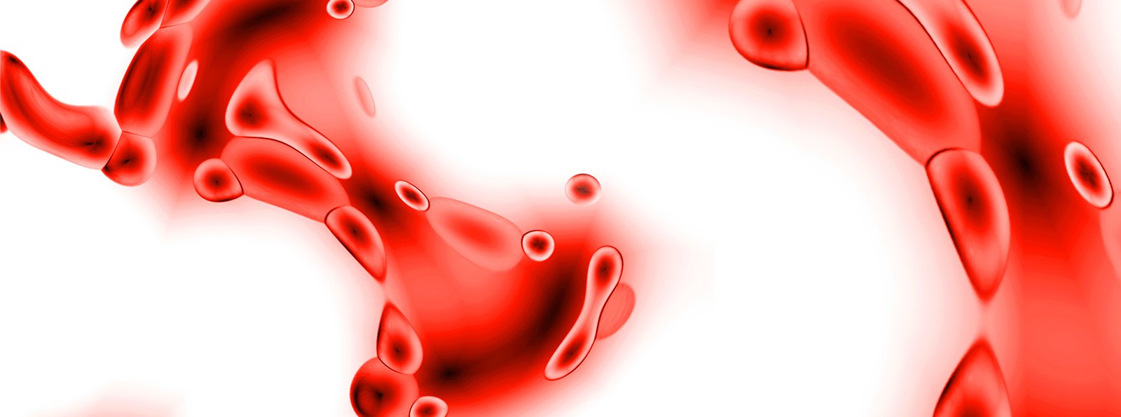 Diagnostyka i leczenie choroby von Willebranda