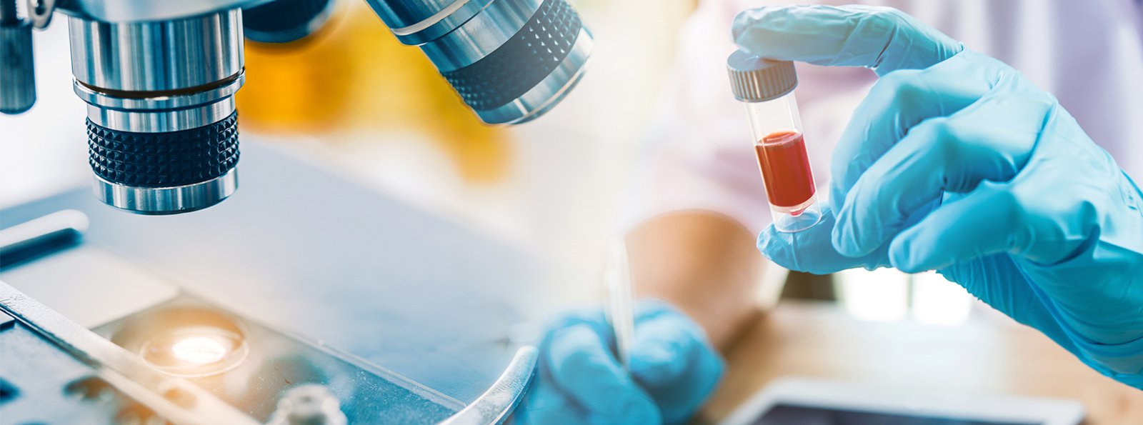 Wyzwania diagnostyczne dotyczące laboratoryjnego wykrywania antykoagulantu tocznia