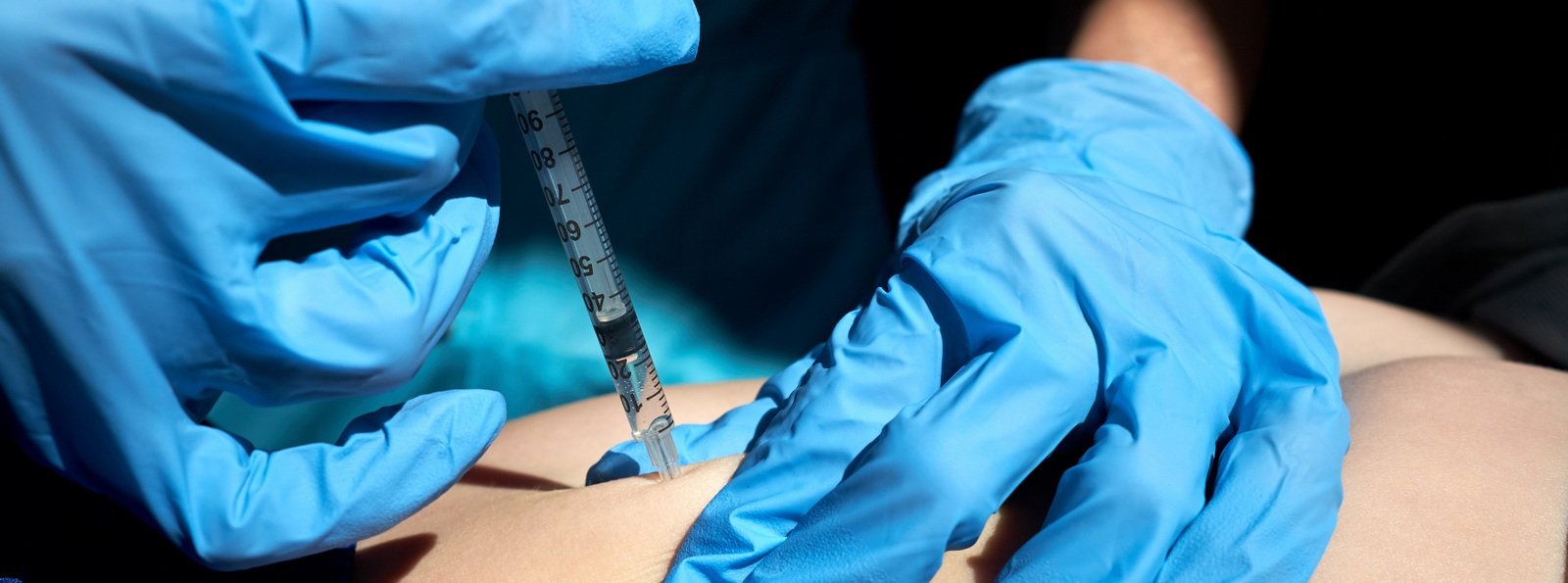 Przewaga antagonistów witaminy K nad bezpośrednimi doustnymi inhibitorami krzepnięcia w leczeniu przeciwzakrzepowym – szczególne sytuacje kliniczne